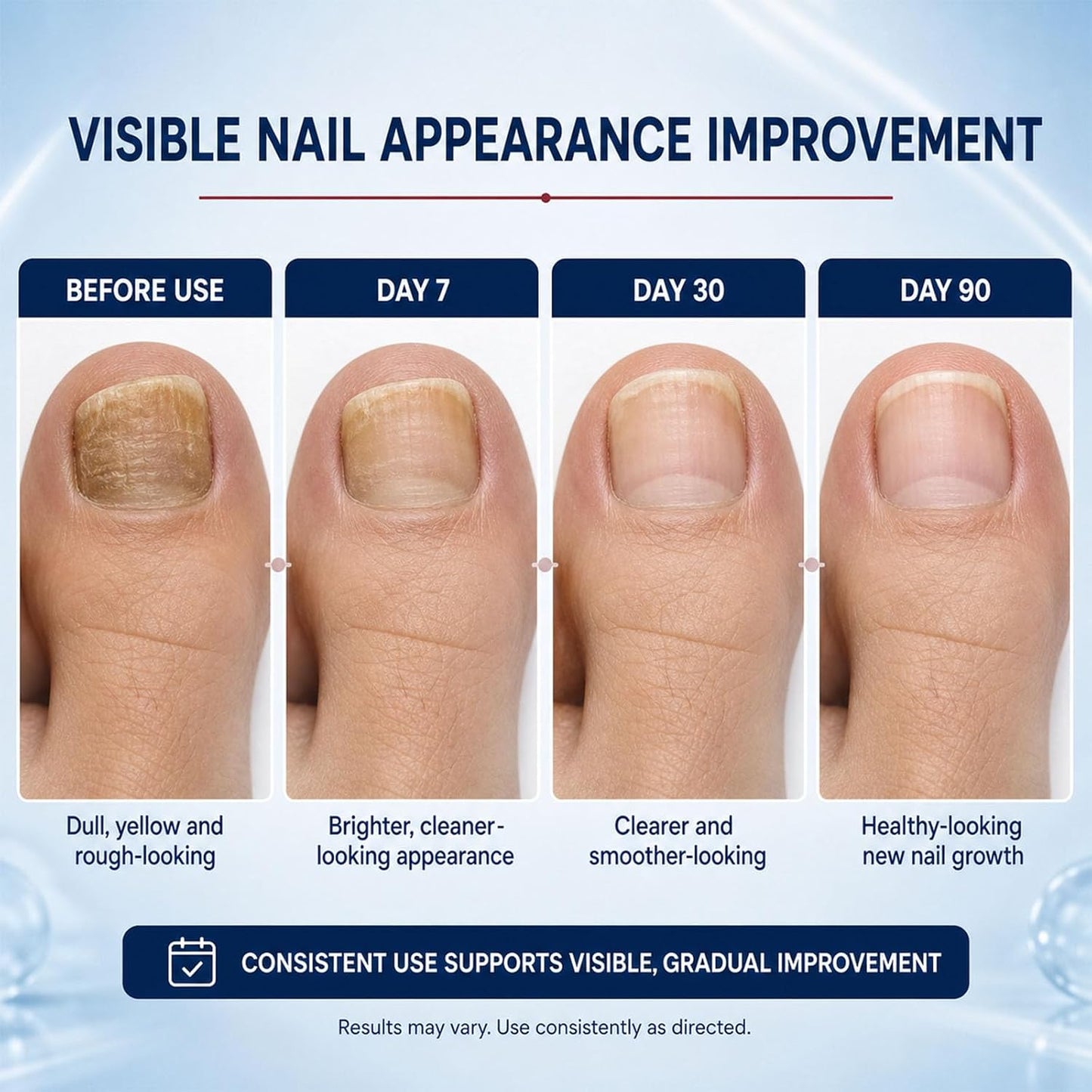 Nail Care Pen with Allicin & Undecylenic Acid for Daily Nail Treatment