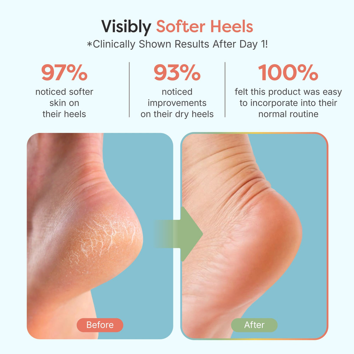 Moisturizing Gel Ankle Sleeve