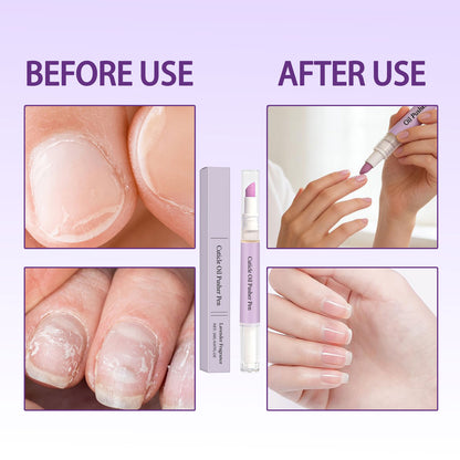 2 Pack Nail Care Oil — Gently Removes Dead Skin