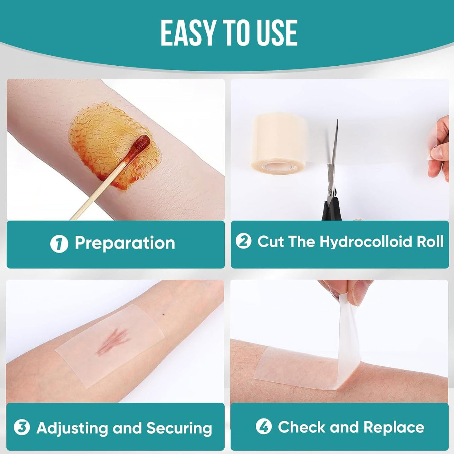 Hydrocolloid Dressing Roll – Waterproof, Anti-Chafing, And Cuttable Tape