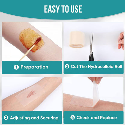 Hydrocolloid Dressing Roll – Waterproof, Anti-Chafing, And Cuttable Tape