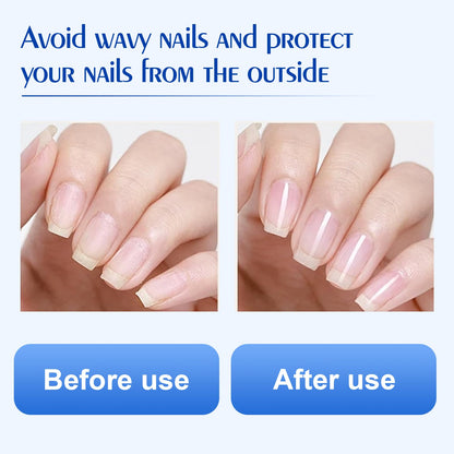 Hyaluronic Acid Nail Hardener for Cracked Cuticles&Dry Nails
