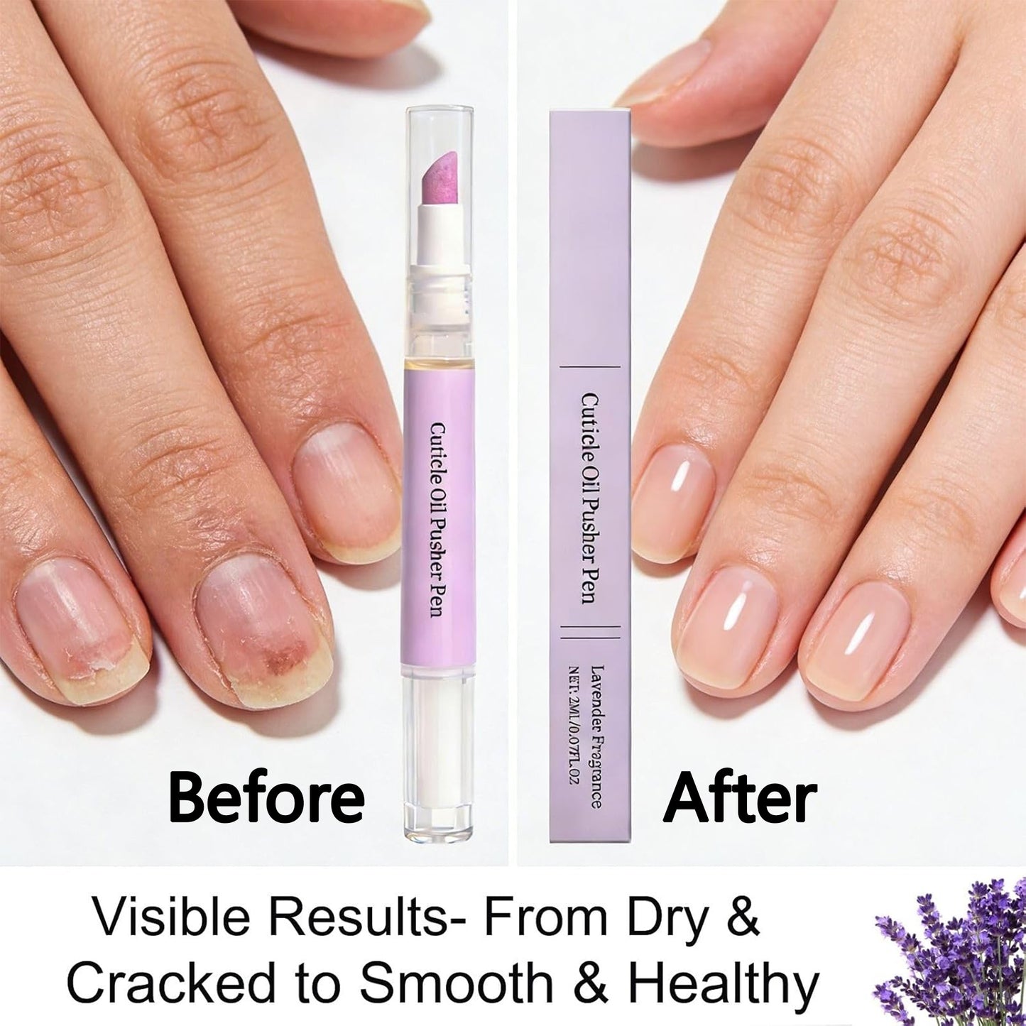 2 Pack Nail Care Oil — Gently Removes Dead Skin