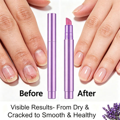 New Nail Care Oil — Gently Removes Dead Skin