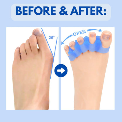 5-Hole Toe Separator for Overlapping Toes