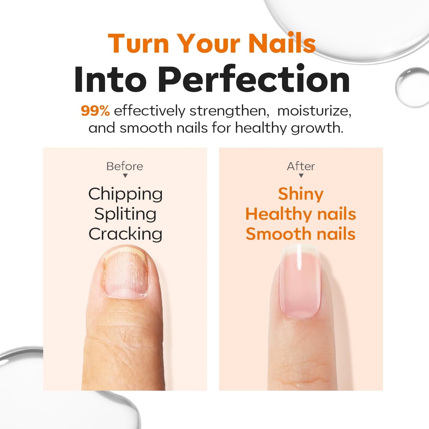 Nail Strengthening And Growth Serum – Suitable For Soft, Brittle Nails