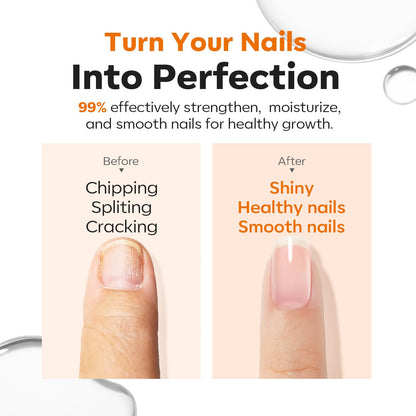 Nail Strengthening And Growth Serum – Suitable For Soft, Brittle Nails