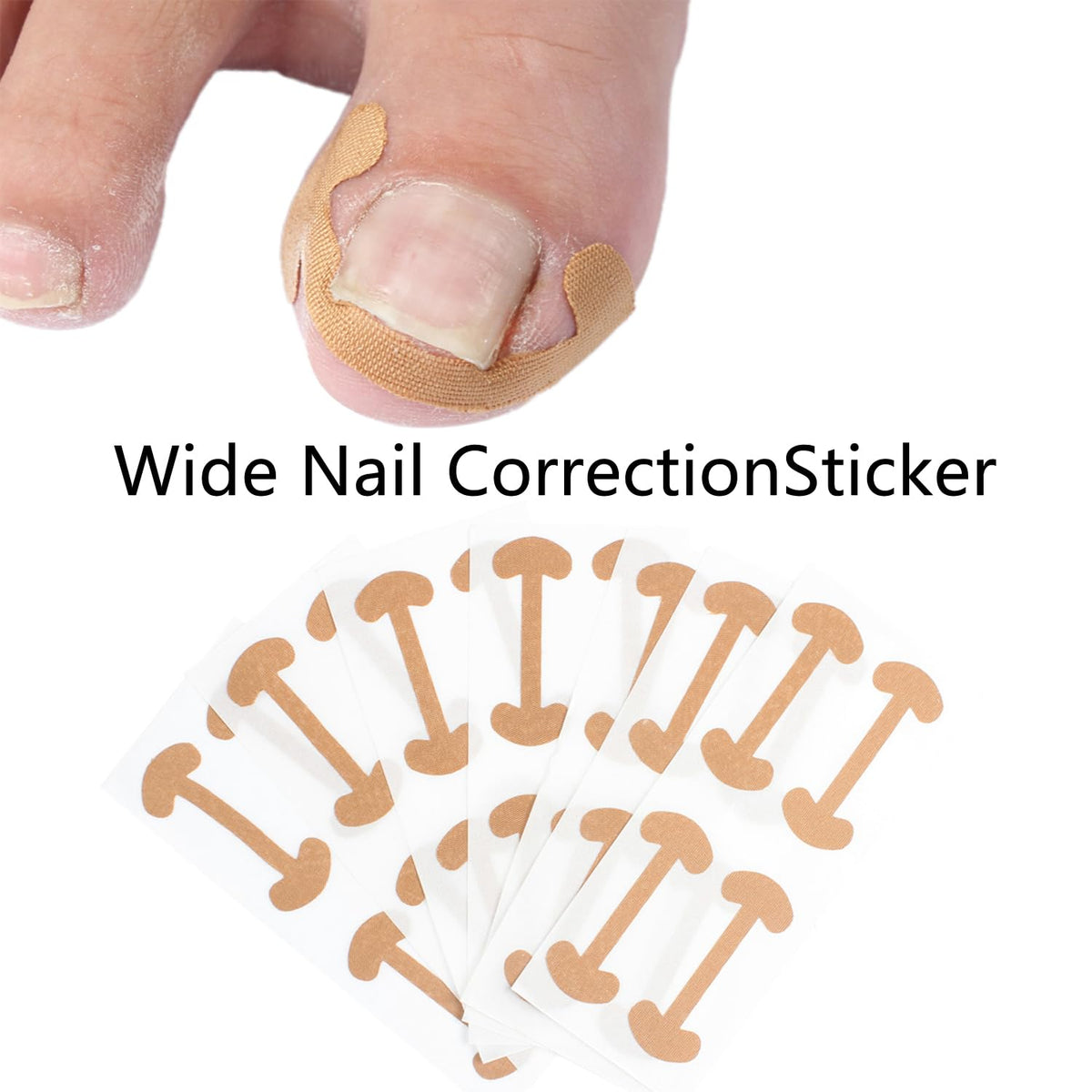 100 SET Ingrown Toenail Correction Treatment Tool, Ingrown Toenail Strips