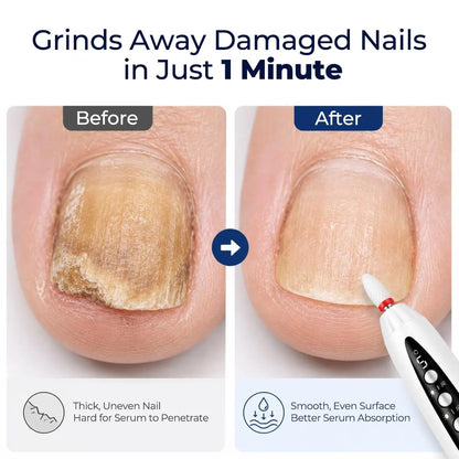 2-In-1 Professional Cordless Nail File With Gel Lamp