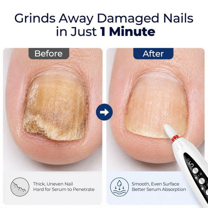 Rechargeable Nail Drill
