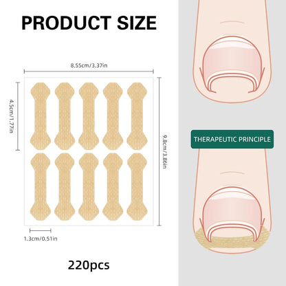 1 Set Ingrown Nail Correction Strips – Fingernail/Toenail Correction Tools and Care Supplies