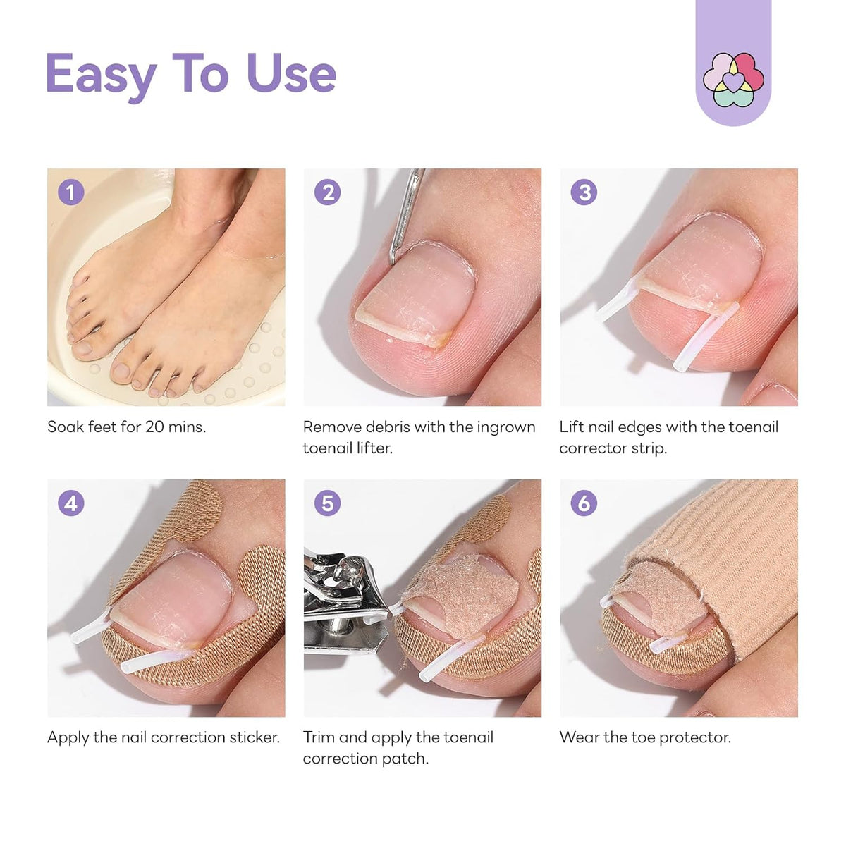 100 SET Ingrown Toenail Correction Treatment Tool, Ingrown Toenail Strips