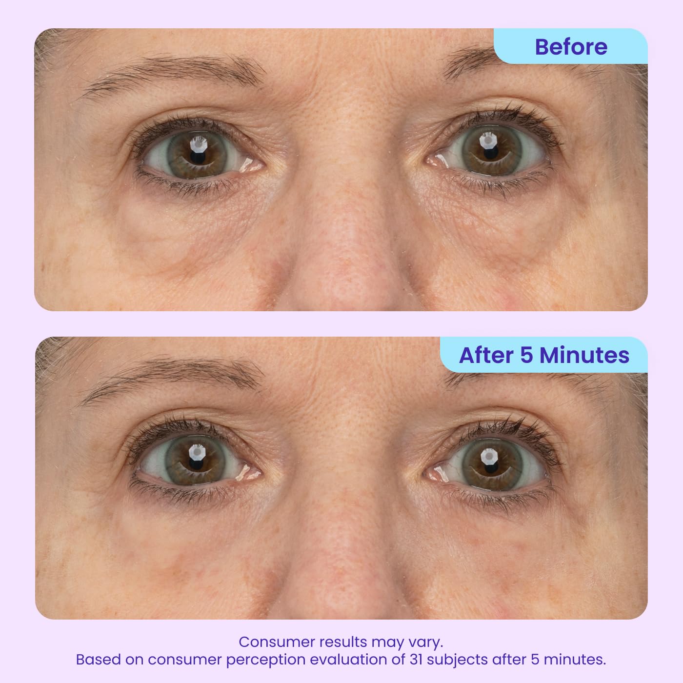 Instant Lift Eye Gel, Tightening and Firming Eye Treatment for Puffiness, Under Eye Bags, Wrinkles, Fine Lines and Dark Circles