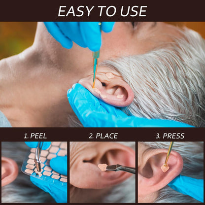 600 Pcs Ear Acupressure Kit  for Wellness & Relaxation