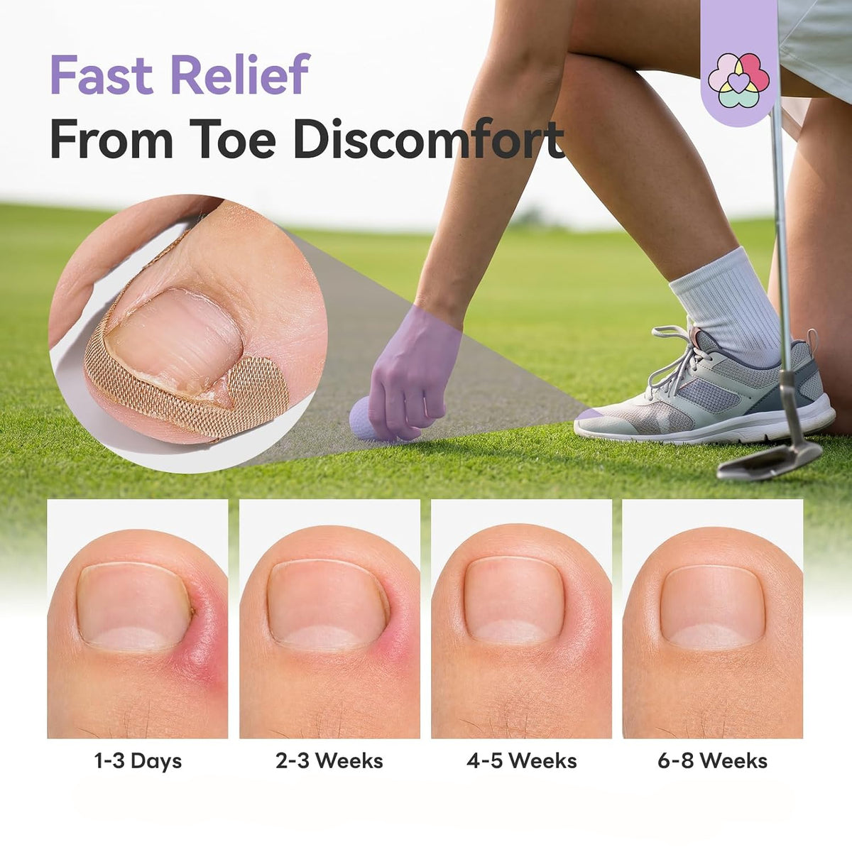 100 SET Ingrown Toenail Correction Treatment Tool, Ingrown Toenail Strips