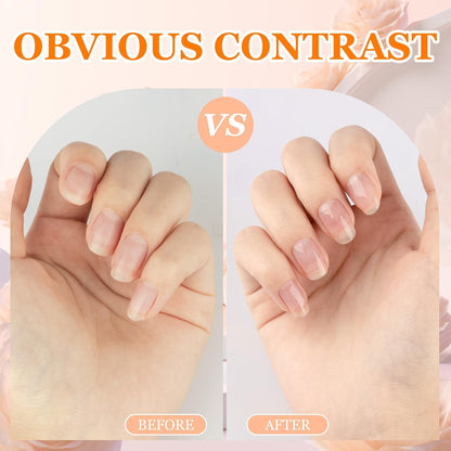3Pcs Cuticle Oil Pen for Nail Care Oil Kit Hangnail Treatment