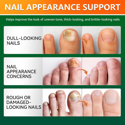 16 PCS Nail Patches for Toenail Repair Support for Damaged, Thick, or Yellow Toenails, Natural Formula