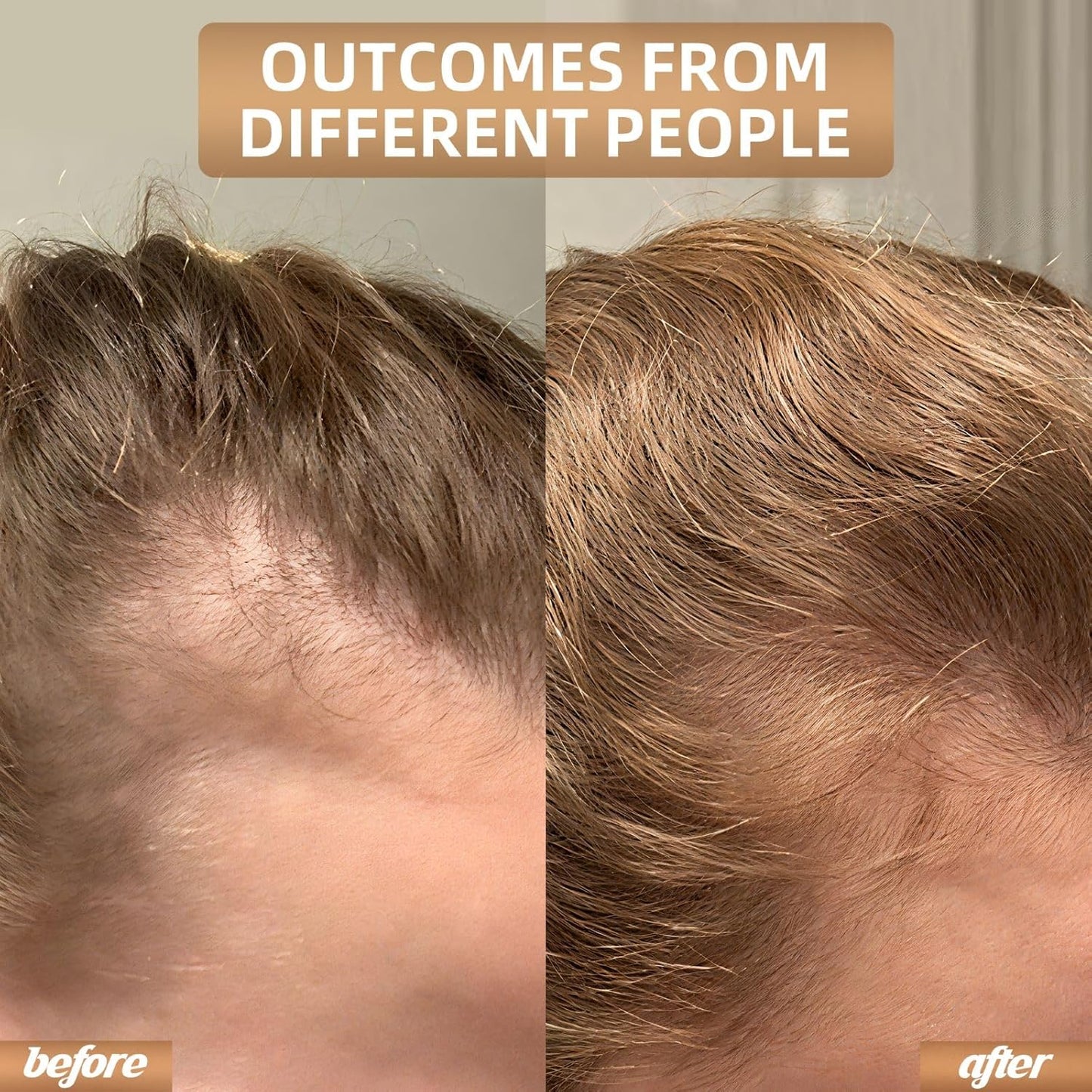Infrared Light Head Hair Care Cap