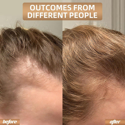 Infrared Light Head Hair Care Cap