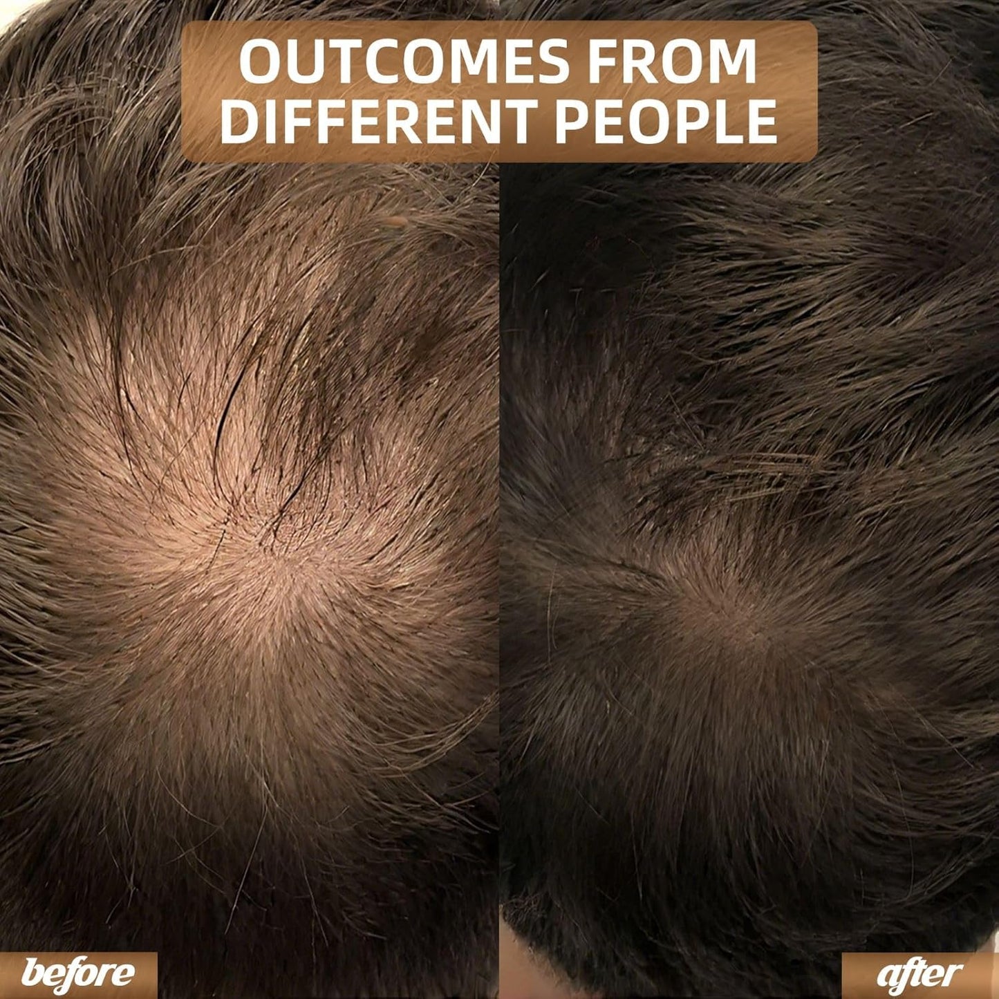 Infrared Light Head Hair Care Cap