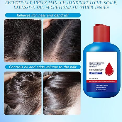 Anti-Dandruff Shampoo – Oil-Control, Refreshing, and Anti-Dandruff Formula