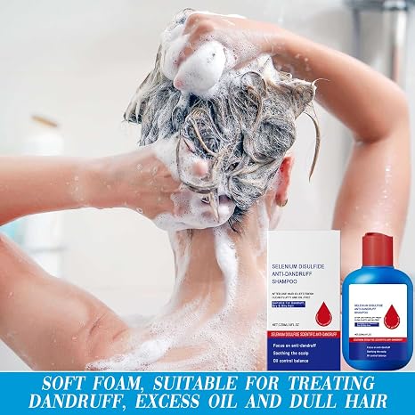 Anti-Dandruff Shampoo – Oil-Control, Refreshing, and Anti-Dandruff Formula
